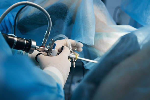 Laparoscopic Surgery
